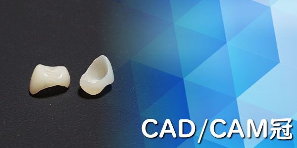 CAD/CAM冠